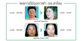เคล็ดลับหน้าใส-ไร้ฝ้า