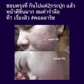 ขาย Collarich คอลลาเจน