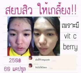 Clcollagenสิวหายใน7วัน
