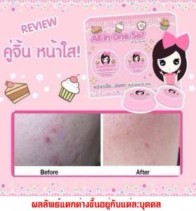 ขาย all in one set (อออินวัน เซตคู่จิ้นหน้าใส)