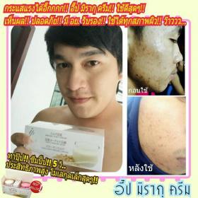 ขาย IP      MIRAKU -