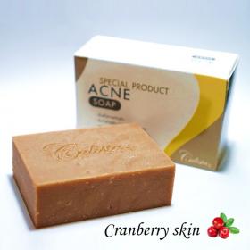 สบู่รักษาสิว Acne Soap