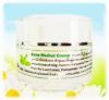 Acne Herbal Cream (ครีมลดสิว) สำหรับลดสิวอักเสบ สิวอุดตัน ลดความมัน ลดการอักเสบ ใช้ทาได้ทั้งผิวหน้า หรือแต้มเป็นจุด ๆ บริเวณที่เป็นสิวก็ได้ค่ะ