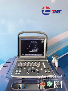 ขายเครื่อง Ultrasound Chison ECO5
