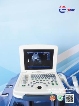 ขายเครื่อง Ultrasound Dawei DW330