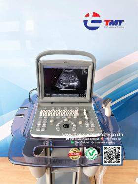 ขายเครื่อง Ultrasound CHISON ECO2 