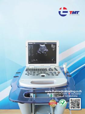 ขายเครื่องultrasound  Dawei DW PF522