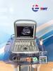 CHISON   ECO2